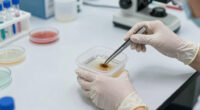 Cdc Parasite Outbreak