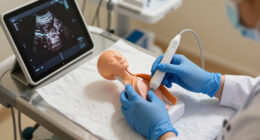 Two Procedures May Yield Similar Symptom Relief For Uterine Fibroids
